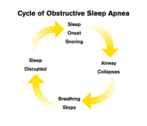 Sleep Apnea or Snoring